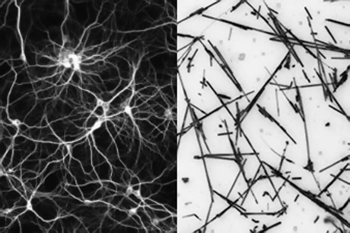 Nanoréseaux : des IA capables d'apprendre comme le cerveau humain.